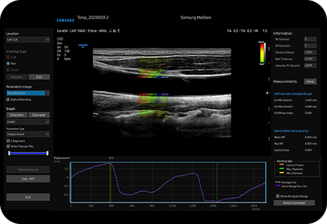 img_ArterialAnalysis
